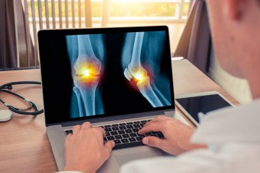 Doktor, dizinde ağrı olan bacakların röntgenini çekmiş bir dizüstü bilgisayarı izliyor. Radyoloji kavramı