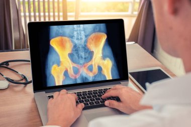 Doktor ağrılı kalça röntgenini izliyor. Radyoloji kavramı