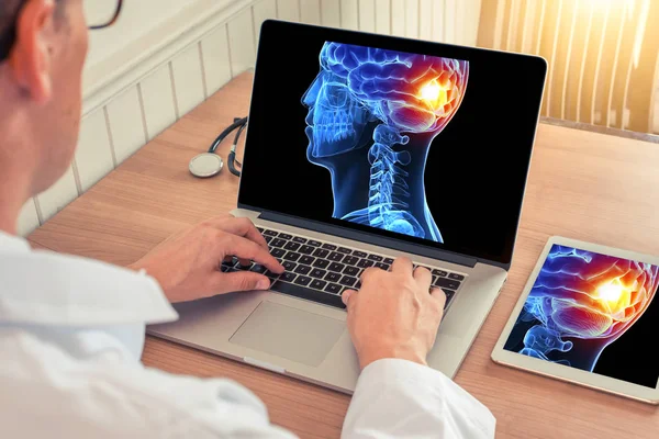 Doktor ofiste beyin ve dijital tablet arka ağrı kesici ile 3d kafatası kafası x-ray ile bir dizüstü bilgisayar izliyor. 