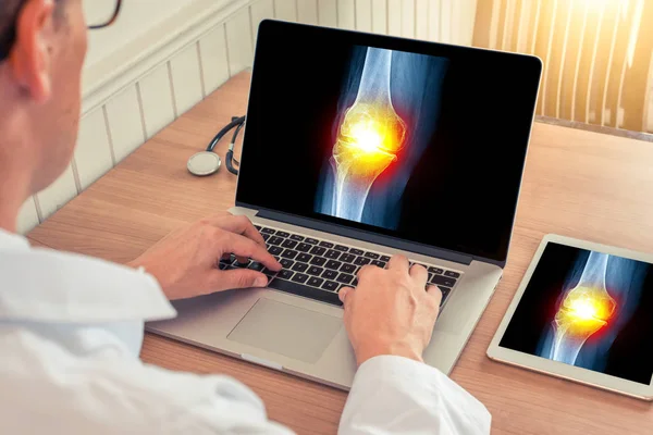 Doktor bir tıp ofisinde diz kemiği üzerinde ağrı kesici ile bacak röntgeni ile bir dizüstü bilgisayar ve dijital tablet izliyor