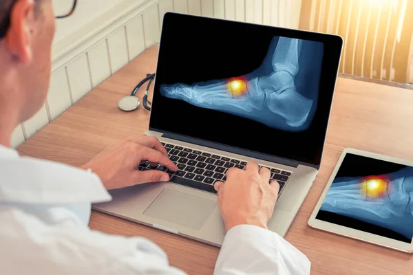Dokter kijken naar een laptop met x-ray van pijnverlichting op de top van een voet in een medisch kantoor — Stockfoto