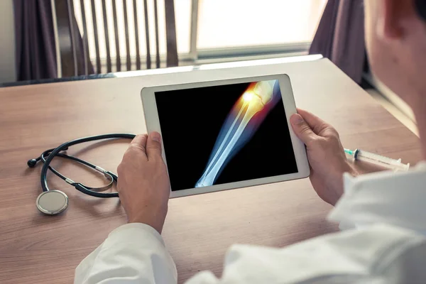 Arts met een digitale tablet met x-ray van been en pijn op de externe knie — Stockfoto