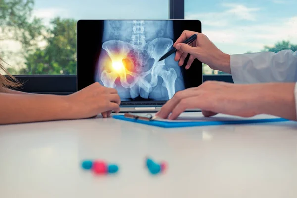 Doktor, dizüstü bilgisayarda sol ağrısı olan kalçaröntgenini bir kadın hastaya gösteriyor. Masadaki haplar