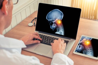 Doktor bir tıp ofisinde boynunun üst kısmında ağrı kesici kafatası x-ray ile bir dizüstü izliyor. Migren kavramı