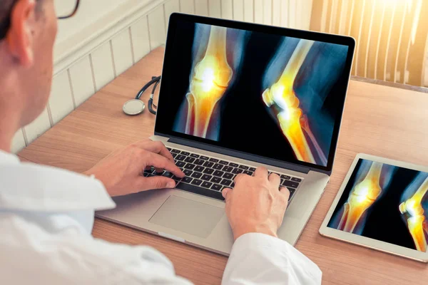 Doktor bir tıp ofisinde bacak kemikleri ağrı kesici ile x-ray ile bir dizüstü bilgisayar ve dijital tablet izliyor
