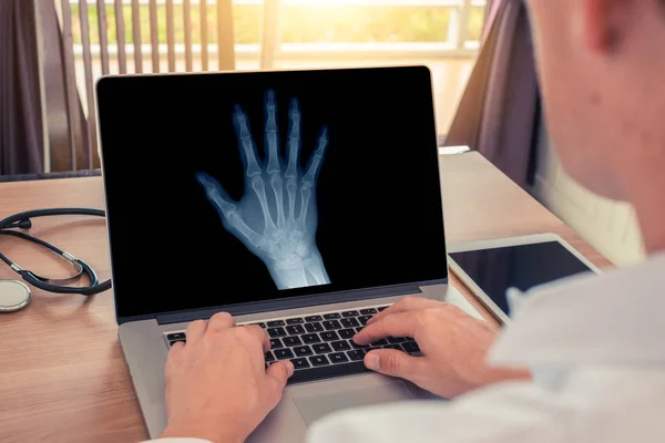 Doktor sağ elin röntgenini izliyor. Radyoloji ve osteoartrit kavramı