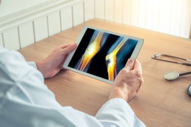 Doktor ağrı ile bacak röntgeni ile dijital tablet tutan