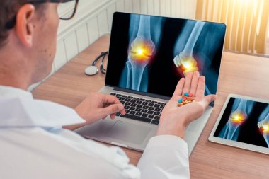 Doktor, dizüstü bilgisayarda dizlerinde ağrı olan bacakların röntgeni ile ilaç hapları tutuyor. Ahşap masada dijital tablet
