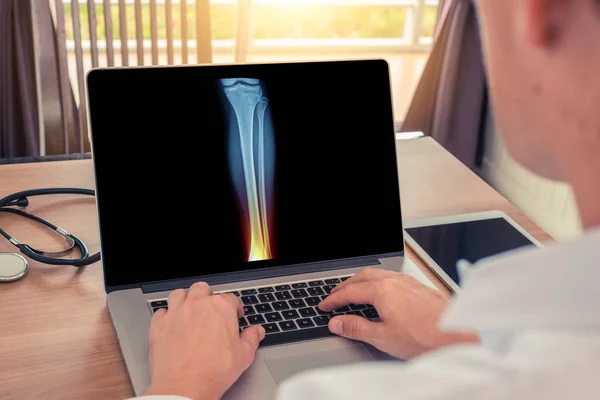 Doctor watching a laptop with x-ray of leg with pain in the ankle. Radiology concept