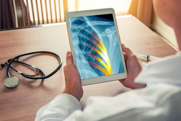 Doktor göğüs röntgeni ve kaburgalarında ağrı olan dijital bir tablet tutuyor. Masanın üzerinde stetoskop ve şırınga