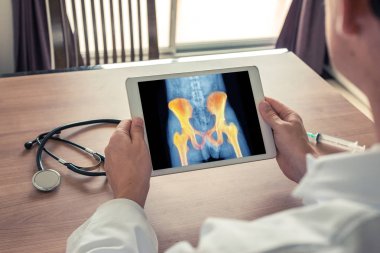 Doktor kalça ve ağrı x-ray ile bir dijital tablet tutan