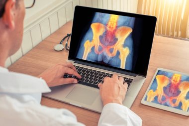 Doktor bir tıp ofisinde ağrı kesici ile kalça ve omurga x-ray ile bir dizüstü bilgisayar ve dijital tablet izliyor