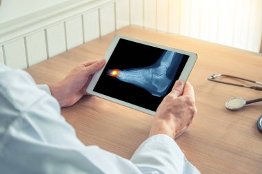 Doktor ayak ayak üzerinde ağrı ile x-ray ile dijital bir tablet tutan