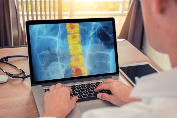 Doktor, omurgasında ağrı olan göğüs röntgenini izliyor. Radyoloji kavramı