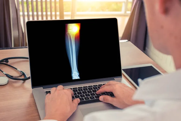 Doktor, dizinde ağrı olan bir bacak röntgeni izliyor. Radyoloji kavramı