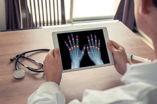 Doktor parmakların eklemlerinde ağrı olan dijital bir tablet tutuyor. Osteoartrit kavramı