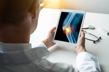 Doktor, dizinde röntgen olan dijital bir tablet tutuyor. Yan görünüm
