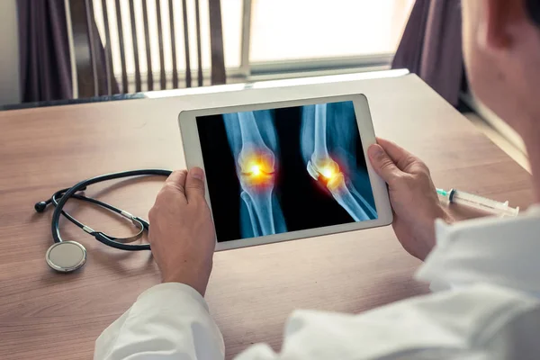 Arts met een digitale tablet met pijn op de knie. Voor-en zijaanzicht — Stockfoto