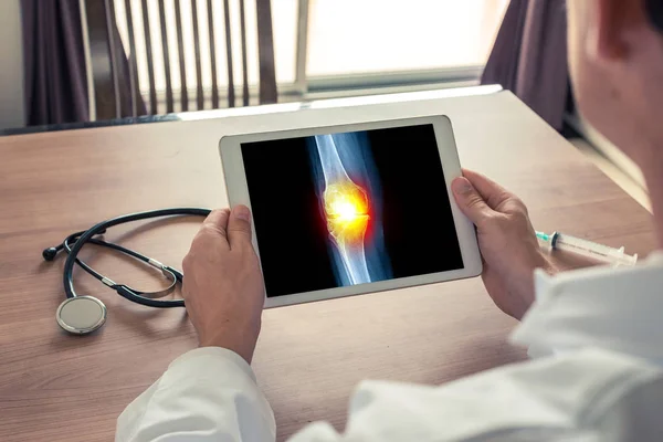 Doktor ağrı ile diz röntgeni ile dijital tablet tutan