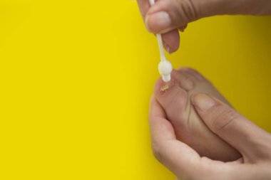 batan Bebek Bakımı takin çivi. Pedikür