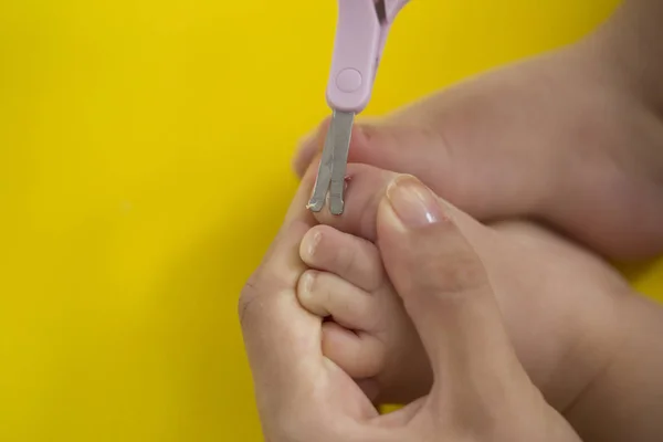 Cutting Ingrowing Baby Nails Pedicure — Stock Photo, Image