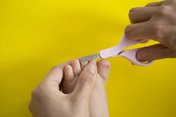 Cutting Ingrowing Baby Nails Pedicure — Stock Photo, Image