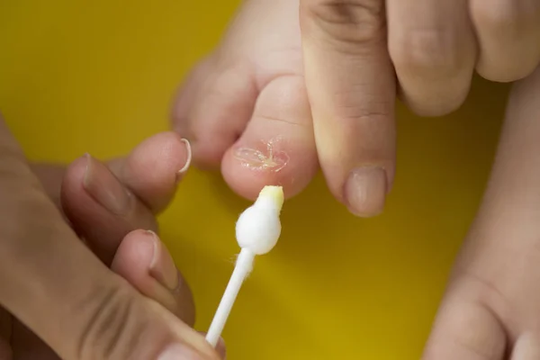 Takin Care Ingrowing Baby Nails Pedicure — Stock Photo, Image