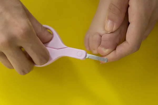 Cutting Ingrowing Baby Nails Pedicure — Stock Photo, Image