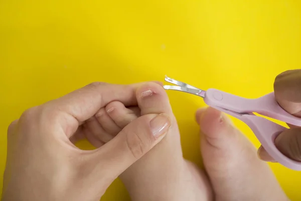 Cutting Ingrowing Baby Nails Pedicure — Stock Photo, Image