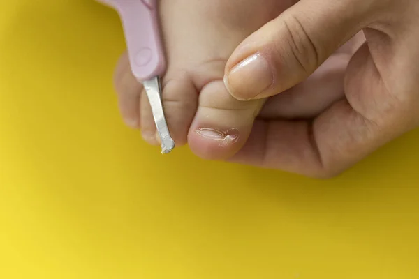 Cutting Ingrowing Baby Nails Pedicure — Stock Photo, Image