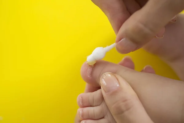 Takin care of ingrowing baby nails. pedicure — Stock Image Takin Care Ingrowing Baby Nails Pedicure Royalty Free Stock Photos