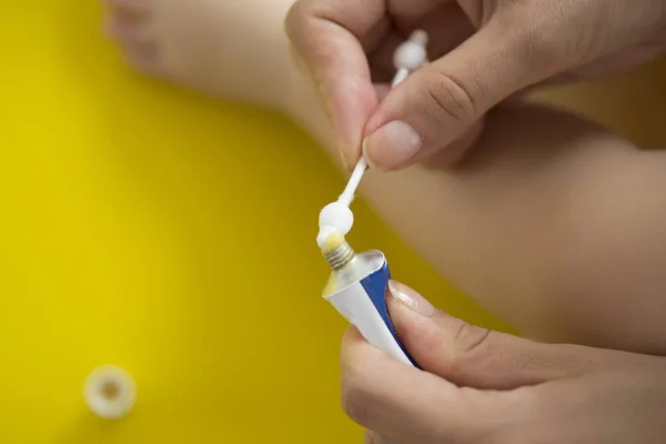 Takin care of ingrowing baby nails. pedicure — Stock Image Takin Care Ingrowing Baby Nails Pedicure Royalty Free Stock Images