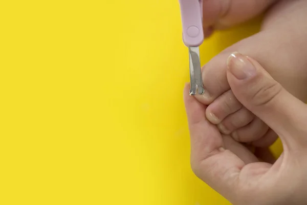 Cutting ingrowing baby nails. pedicure — Stock Image Cutting Ingrowing Baby Nails Pedicure Stock Picture