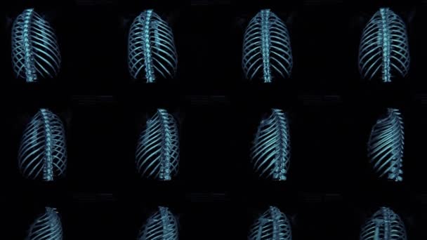 Resonancia Magnética Tórax Monitor Rayos Del Cuerpo Humano — Vídeos de Stock