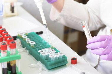 Kan örnekleri analiz önce hazırlanması