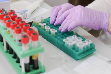 Kan örnekleri analiz önce hazırlanması