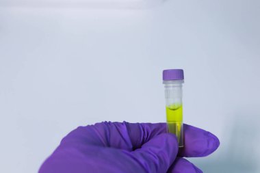 Pcr laboratuvar tüplerde. Pcr analizi için genetik hastalıklar ve enfeksiyonlar in vitro kimyasalları.