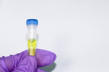 Pcr laboratuvar tüplerde. Pcr analizi için genetik hastalıklar ve enfeksiyonlar in vitro kimyasalları.