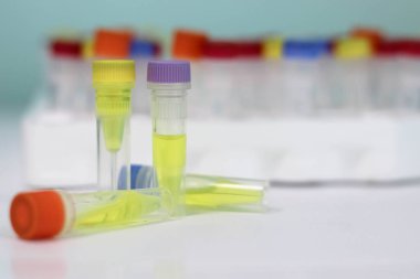 Pcr laboratuvar tüplerde. Pcr analizi için genetik hastalıklar ve enfeksiyonlar in vitro kimyasalları.
