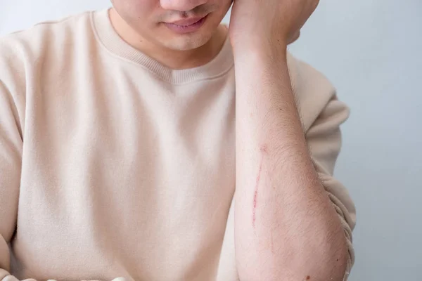 Men Feel Pain Arms Caused Accidents — Stock Photo, Image