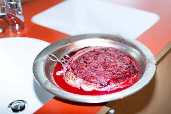 Göbek kordonu ve bir Lavabonun yanındaki metal bir plaka üzerinde cerrahi makas ile insan plasenta.