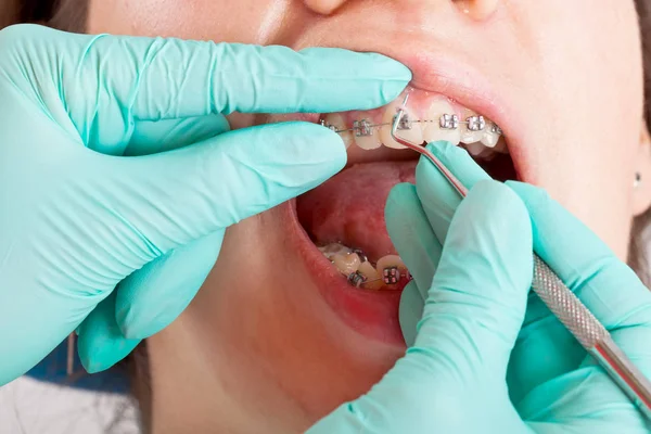 Close Teenager Boy Wearing Braces Dentist Office Dental Check — Stock Photo, Image