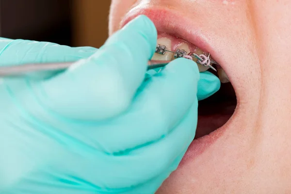 Close Adolescente Menino Vestindo Aparelho Consultório Odontológico Para Check Dentário — Fotografia de Stock