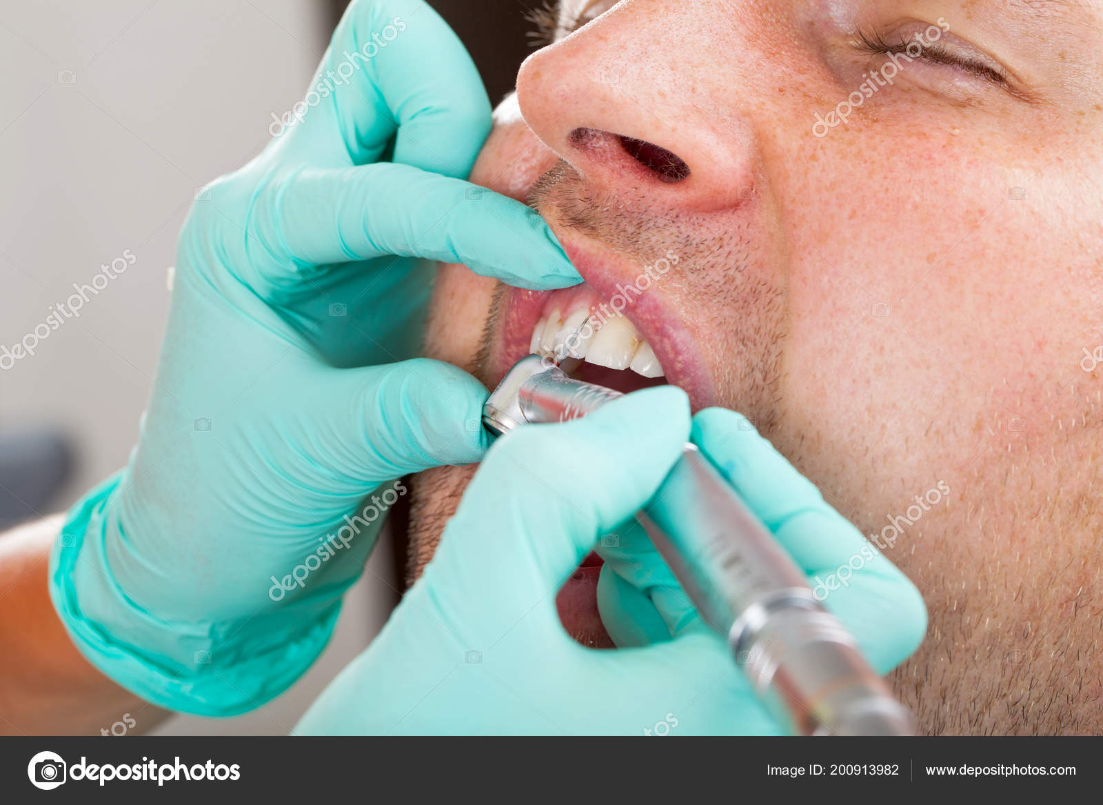 Close Picture Dentist Using Drill Dental Treatment Male Patient Oral