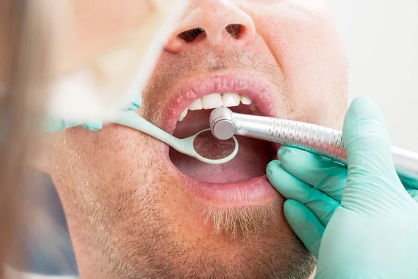 Zavřít Obrázek Zubař Pomocí Vrtáku Pro Zubní Ošetření Mužský Pacient — Stock fotografie