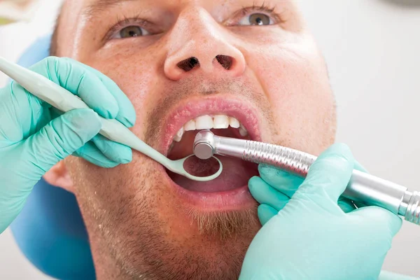 Immagine Ravvicinata Del Dentista Utilizzando Trapano Trattamento Dentale Cavità Orale — Foto Stock