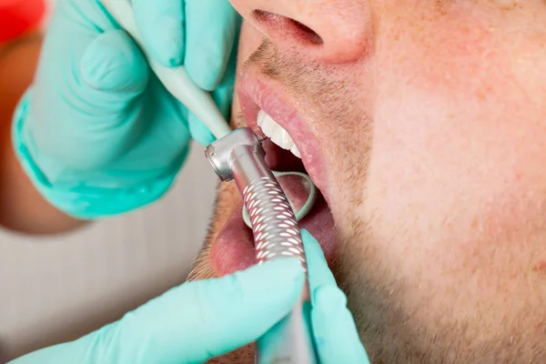 Fotoğrafı Bir Dişçi Diş Tedavisi Erkek Hastanın Ağız Boşluğu Matkap — Stok fotoğraf