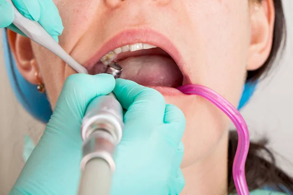 Imagem Perto Procedimento Dentário Paciente Feminina — Fotografia de Stock