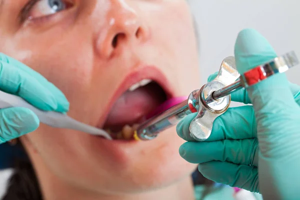 Imagem Perto Paciente Sexo Feminino Consultório Odontológico Recebendo Anestesia Dentária — Fotografia de Stock