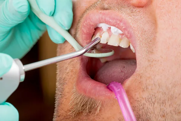 Uomo Ottenere Riempimento Dentale Anteriore — Foto Stock